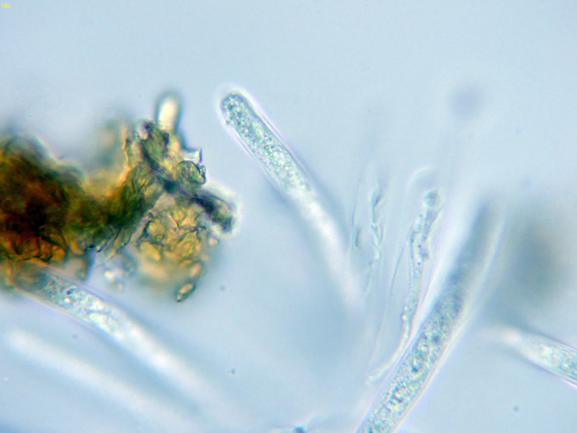 Microscopía de Discostroma corticola - 12 - Asco agua -001
